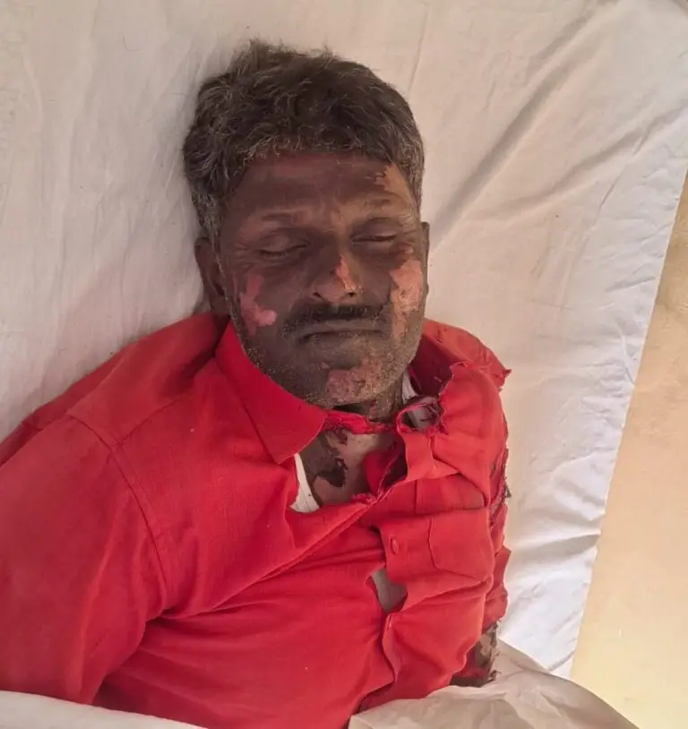 संविदा कर्मी लाइनमैन की विद्युत करंट से हुई मौत