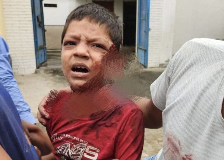 आजमगढ़ में किशोर की गला रेत कर मारने की कोशिश, बंद कमरे में घटना को अंजाम देने का किया प्रयास, आरोपी को लिया गया हिरासत में